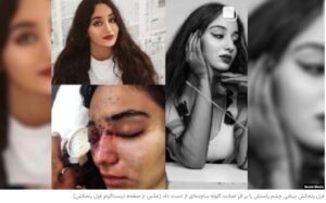 گاردین: نیروهای جمهوری اسلامی به صورت و اندام‌های جنسی زنان شلیک می‌کنند.